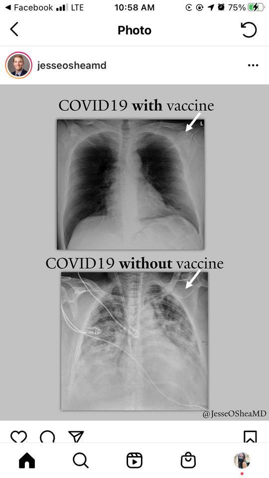Vax vs. un-vax